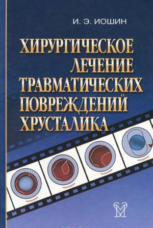 Khirurgicheskoe lechenie travmaticheskikh povrezhdenij khrustalika