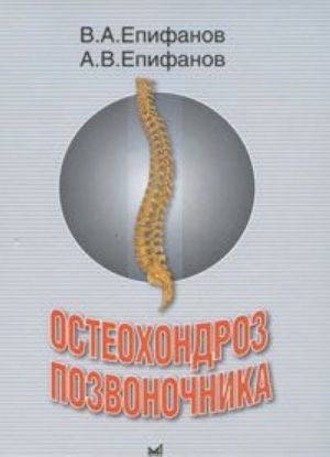 Osteokhondroz pozvonochnika