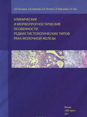 Klinicheskie i morfoprognosticheskie osobennosti redkikh gistologicheskikh tipov raka molochnoj zhelezy