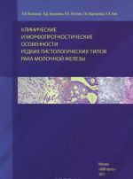 Klinicheskie i morfoprognosticheskie osobennosti redkikh gistologicheskikh tipov raka molochnoj zhelezy