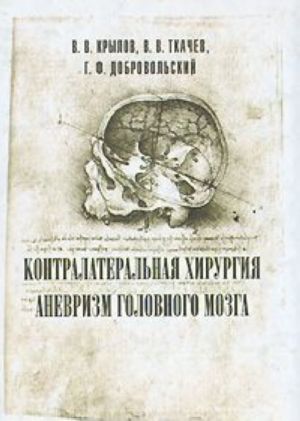 Контралатеральная хирургия аневризм головного мозга