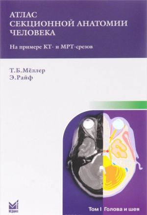 Atlas sektsionnoj anatomii cheloveka na primere KT- i MRT- srezov. V 3 tomakh. Tom 1. Golova i sheja