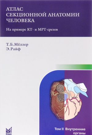 Atlas sektsionnoj anatomii cheloveka na primere KT- i MRT- srezov. V 3 tomakh. Tom 2. Vnutrennie organy