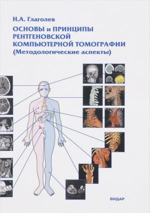 Osnovy i printsipy rentgenovskoj kompjuternoj tomografii. Metodologicheskie aspekty