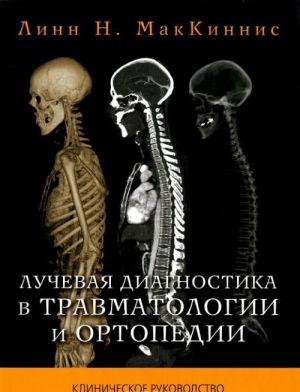 Luchevaja diagnostika v travmatologii i ortopedii . Klinicheskoe rukovodstvo