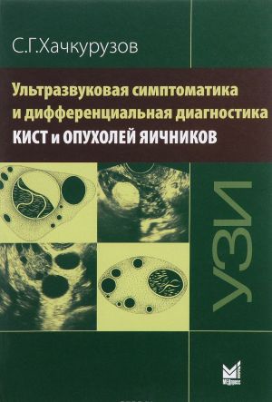 Ultrazvukovaja simptomatika i differentsialnaja diagnostika kist i opukholej jaichnikov