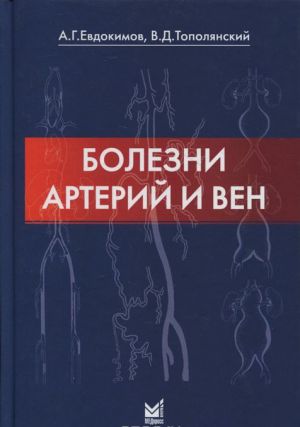 Болезни артерий и вен