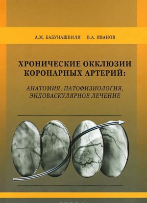 Khronicheskie okkljuzii koronarnykh arterij. Anatomija, patofiziologija, endovaskuljarnoe lechenie