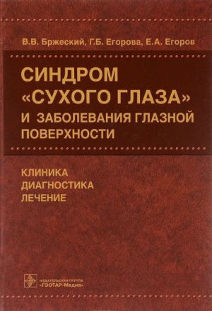 Синдром "сухого глаза" и заболевания глазной поверхности. Клиника, диагностика, лечение