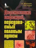 Диагностика инфекций, передаваемых половым путем