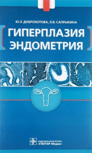 Giperplazija endometrija