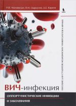 ВИЧ-инфекция. Оппортунистические инфекции и заболевания