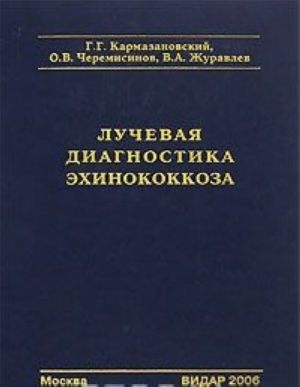 Лучевая диагностика эхинококкоза