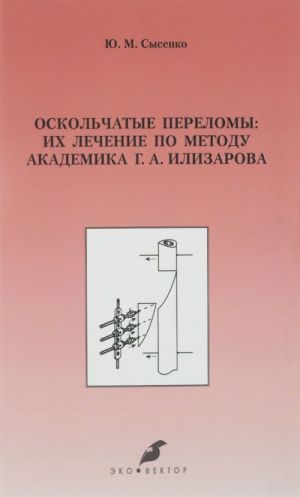 Oskolchatye perelomy: ikh lechenie po metodu akademika G. A. Ilizarova