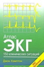 Atlas EKG. 150 klinicheskikh situatsij