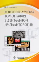 Конусно-лучевая томография в дентальной имплантологии