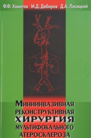 Miniinvazivnaja rekonstruktivnaja khirurgija multifokalnogo ateroskleroza