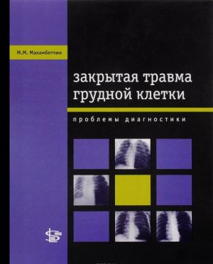 Закрытая травма грудной клетки. Проблемы диагностики