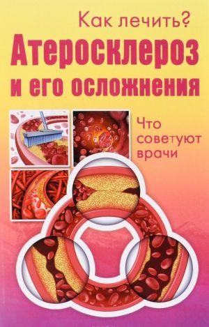 Атеросклероз и его осложнения. Что советуют врачи