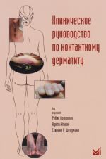 Klinicheskoe rukovodstvo po kontaktnomu dermatitu. Diagnostika i lechenie v zavisimosti ot oblasti porazhenija