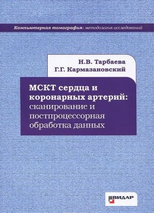 МСКТ сердца и коронарных артерий. Сканирование и постпроцессорная обработка данных