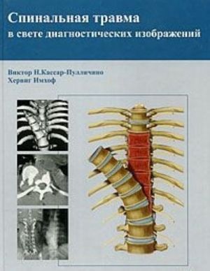 Spinalnaja travma v svete diagnosticheskikh izobrazhenij