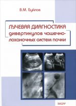 Luchevaja diagnostika divertikulov chashechno-lokhanochnykh sistem pochki