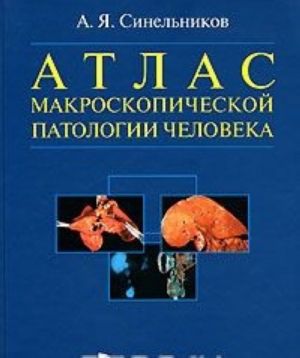 Атлас макроскопической патологии человека