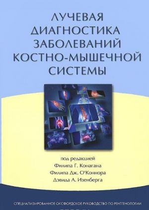 Luchevaja diagnostika zabolevanij kostno-myshechnoj sistemy