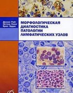 Morfologicheskaja diagnostika patologii limfaticheskikh uzlov