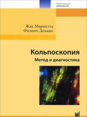 Kolposkopija. Metod i diagnostika. Prakticheskoe rukovodstvo