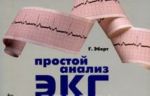 Prostoj analiz EKG. Interpretatsija, differentsialnyj diagnoz