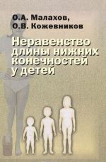 Неравенство длины нижних конечностей у детей