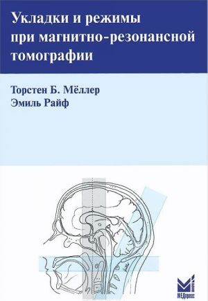 Укладки и режимы при магнитно-резонансной томографии