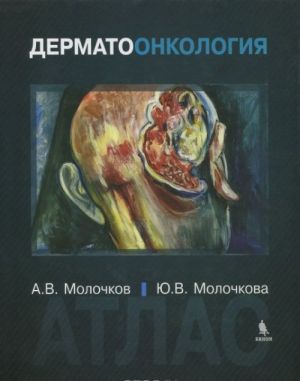 Dermatoonkologija. Atlas