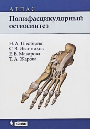 Polifastsikuljarnyj osteosintez. Atlas