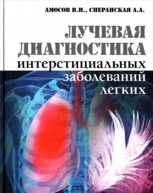 Luchevaja diagnostika interstitsialnykh zabolevanij legkikh