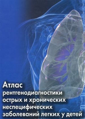 Atlas rentgenodiagnostiki ostrykh i khronicheskikh nespetsificheskikh zabolevanij legkikh u detej