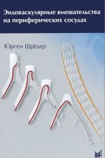 Эндоваскулярные вмешательства на периферических сосудах. Иллюстрированное руководство