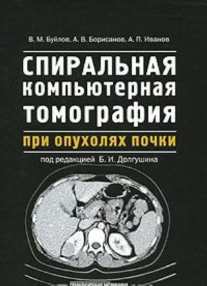 Спиральная компьютерная томография при опухолях почки