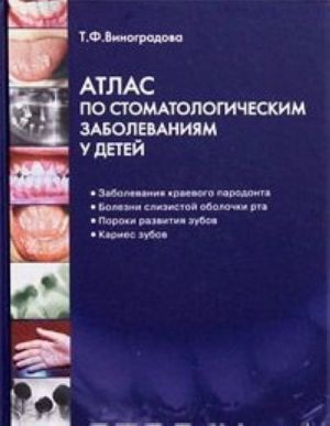 Атлас по стоматологическим заболеваниям у детей (+ CD-ROM)