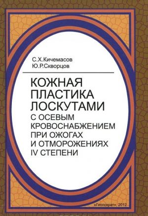 Kozhnaja plastika loskutami s osevym krovosnabzheniem pri ozhogakh i otmorozhenijakh IV stepeni