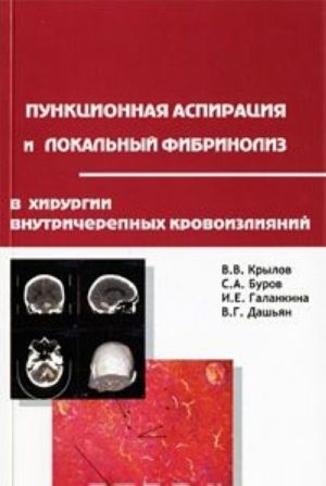 Punktsionnaja aspiratsija i lokalnyj fibrinoliz v khirurgii vnutricherepnykh krovoizlijanij