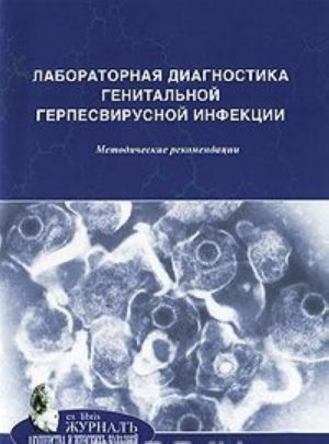 Laboratornaja diagnostika genitalnoj gerpesvirusnoj infektsii