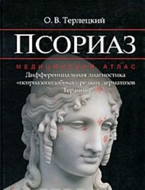 Psoriaz. Differentsialnaja diagnostika "psoriazopodobnykh" redkikh dermatozov. Terapija. Meditsinskij atlas