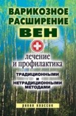 Варикозное расширение вен. Лечение и профилактика традиционными и нетрадиционными методами