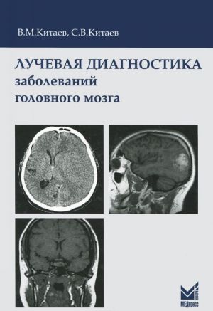 Luchevaja diagnostika zabolevanij golovnogo mozga