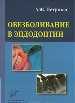 Obezbolivanie v endodontii