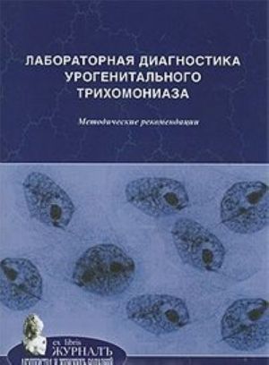 Laboratornaja diagnostika urogenitalnogo trikhomoniaza