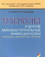 Tuberkulez i drugie mikobakterialnye infektsii kozhi. Patogenez, diagnostika, lechenie
